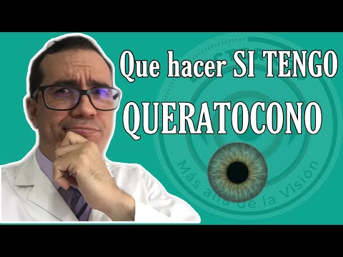 👀 👁 Que hacer si tengo QUERATOCONO en los OJOS? [2020] ✌🏼👊 👨🏻‍⚕️