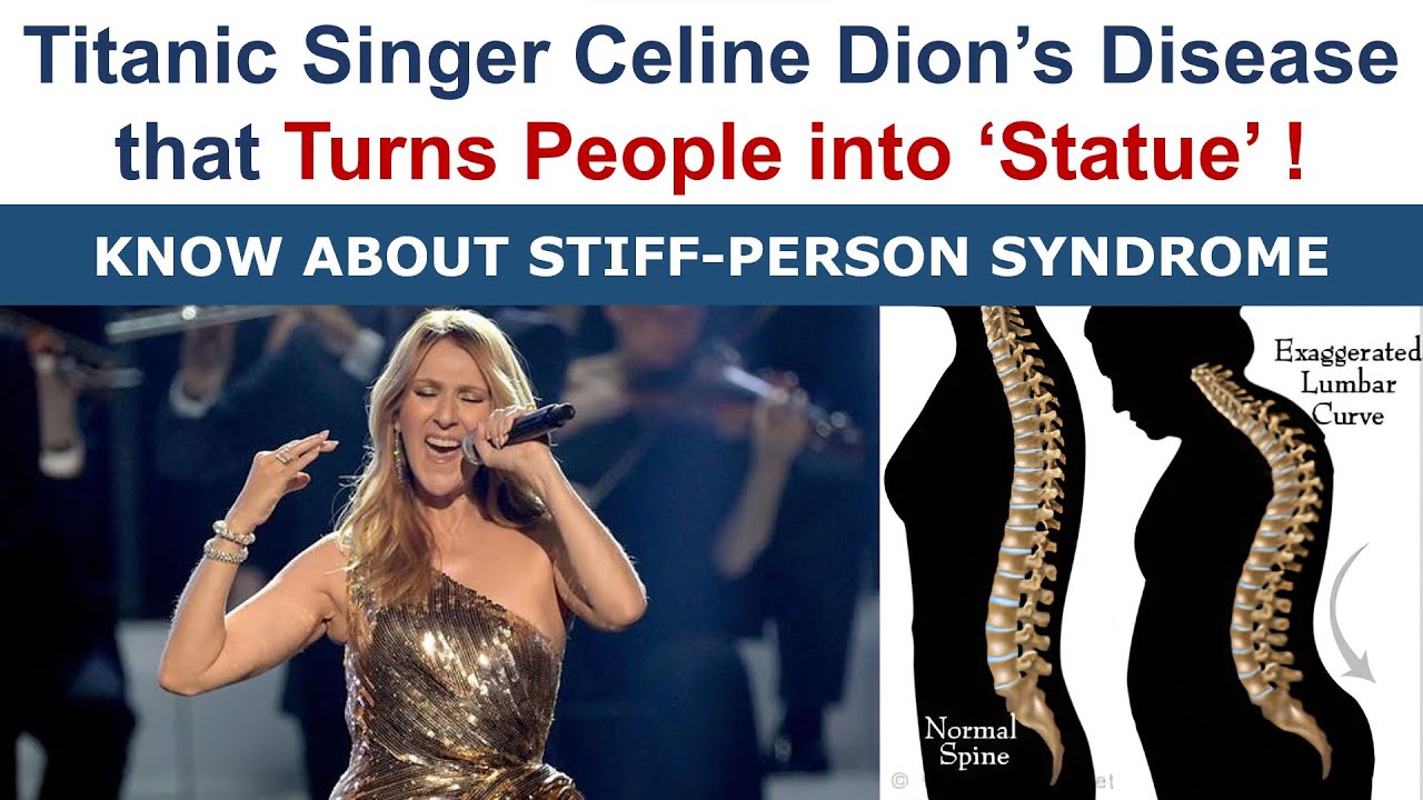 What is Celine Dion's 'Human Statue' illness ? Know about Stiffperson