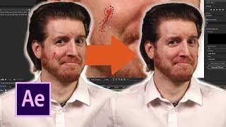 EPIC Blemish Removal in your videos! | Adobe After Effects