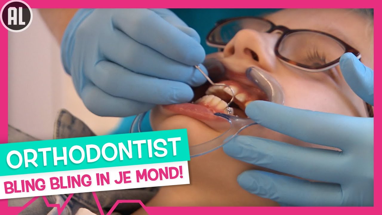 BEUGEL ERIN 😬 EN ERUIT!😁 - TOPDOKS SPECIALISME