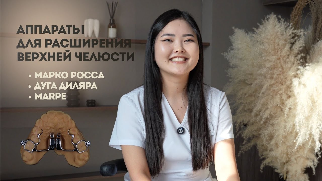 Расширение верхней челюсти: MARPE, Марко Росса или лицевая дуга — что выбрать?