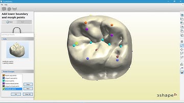 How to edit Anatomical Smile Libraries in 3Shape