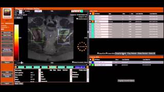 Quantification of static and dynamic MRI data