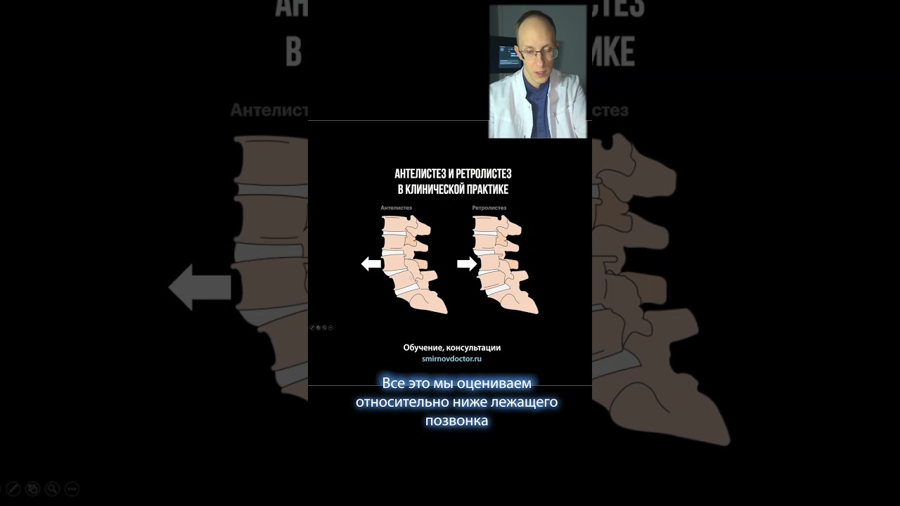 Что такое антелистез и ретролистез?