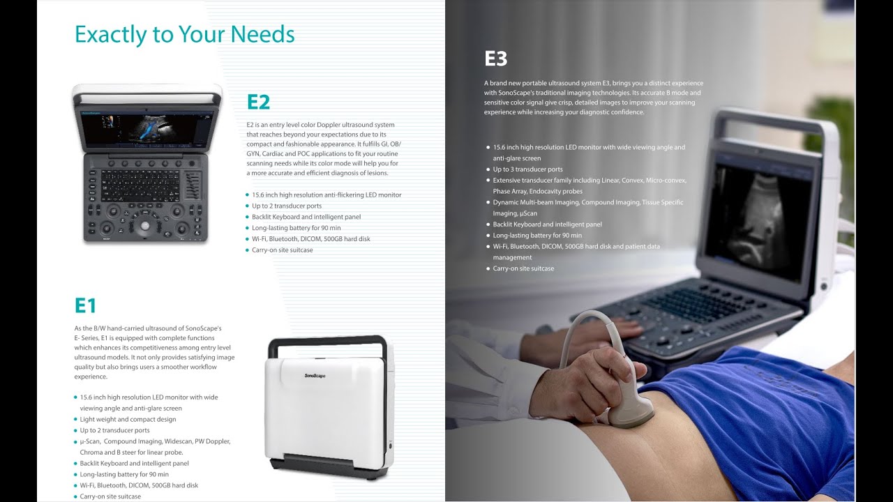 sonoscape E serise with new probe cheapest portable ultrasound scanner