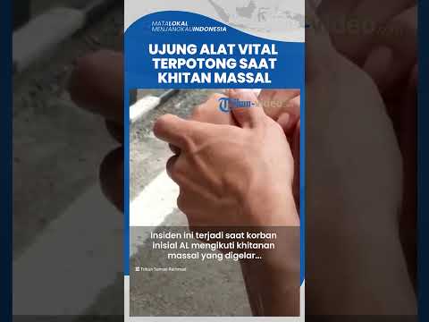 Nasib Pilu Bocah di Lahat, Ujung Kemaluan Terpotong saat Khitanan Massal