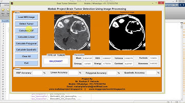 Matlab Code for Brain Tumor Detection and Classification