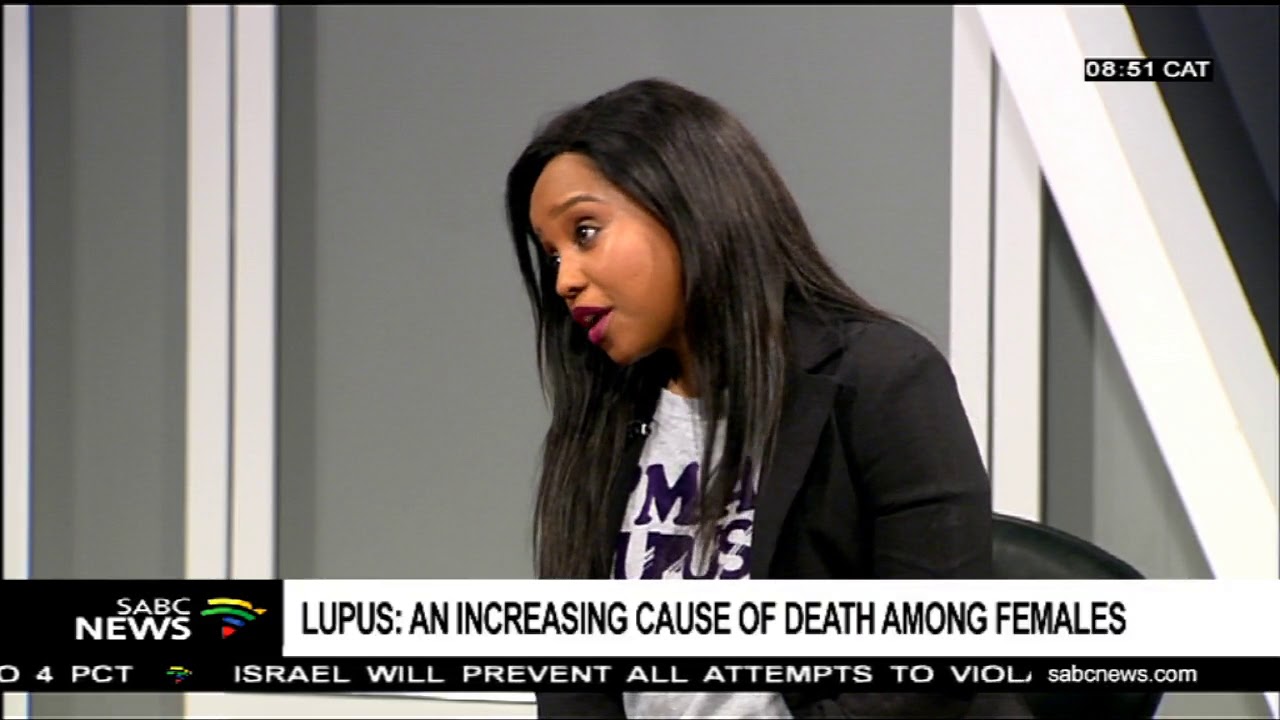 Lupus: An increasing cause of death among females