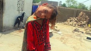 This Girl Lived With Her Neck Bent at a 90-Degree Angle for 12 Years. The Story of Afsheen Gul by Wonders of the World 2,320 views 3 months ago 8 minutes, 12 seconds