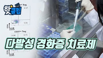 다발성 경화증 치료제의 개발 [핫클립] / YTN 사이언스