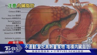 偏愛吃這幾類食物...堆積「內臟脂肪」不改善...醫警告罹癌機率增!｜十點不一樣20220701