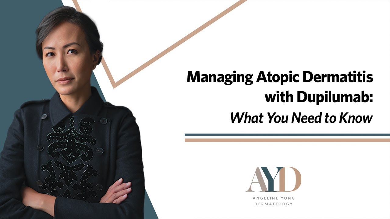 Managing Atopic Dermatitis with Dupilumab: What You Need to Know
