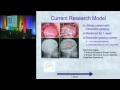 2011 Frontiers of Engineering: The Evolution of Neuroprosthetics