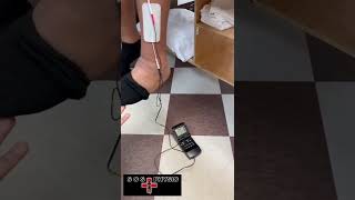 Nmes For Foot Drop With Some Manual Istance From The.