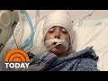 In Twist Of Fate, Motocross Accident Saves 9-Year-Old’s Life | TODAY