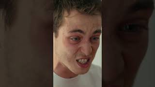 Masum Gencin Ölümü Yüzünden Birbirlerini Suçladılar Ül