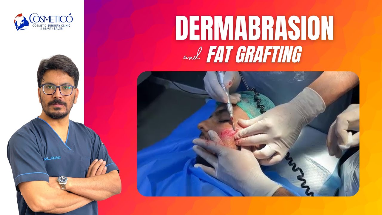 Dermabrasion Scar Removal Treatment Dr. Kamal Uddin Khan Cosmetico