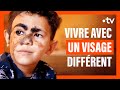 Comment cet enfant de 6 ans vit sa diffrenceau quotidien   documentaire