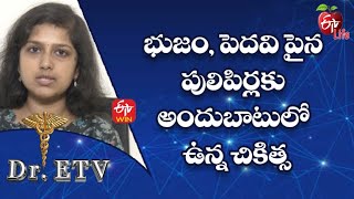 Available Treatment For Soft Warts On Shoulder And Lips | Dr.ETV | 14th Nov 2022 | ETV Life screenshot 2