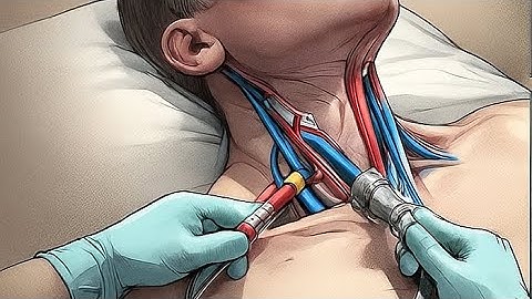 34,Embalming restricted cervical injection 