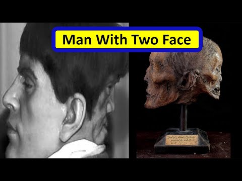 Edward Mordake: the Man with Two Faces | Know the facts