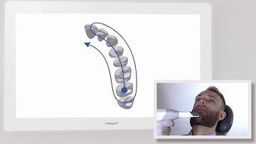 3DBioCAD - 3Shape TRIOS Scan Strategy - Quadrant