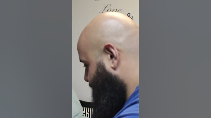#shorts #laserhairremoval #bald #baldness #miami