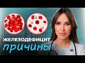 НЕ ПЕЙТЕ добавки с железом, пока не посмотрите ЭТО ВИДЕО