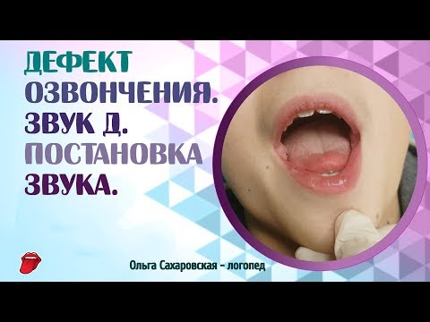 Дефект озвончения. Звук Д. Что делать, если ребёнок оглушает согласные звуки?