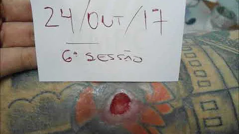 Quando usar ILIB?
