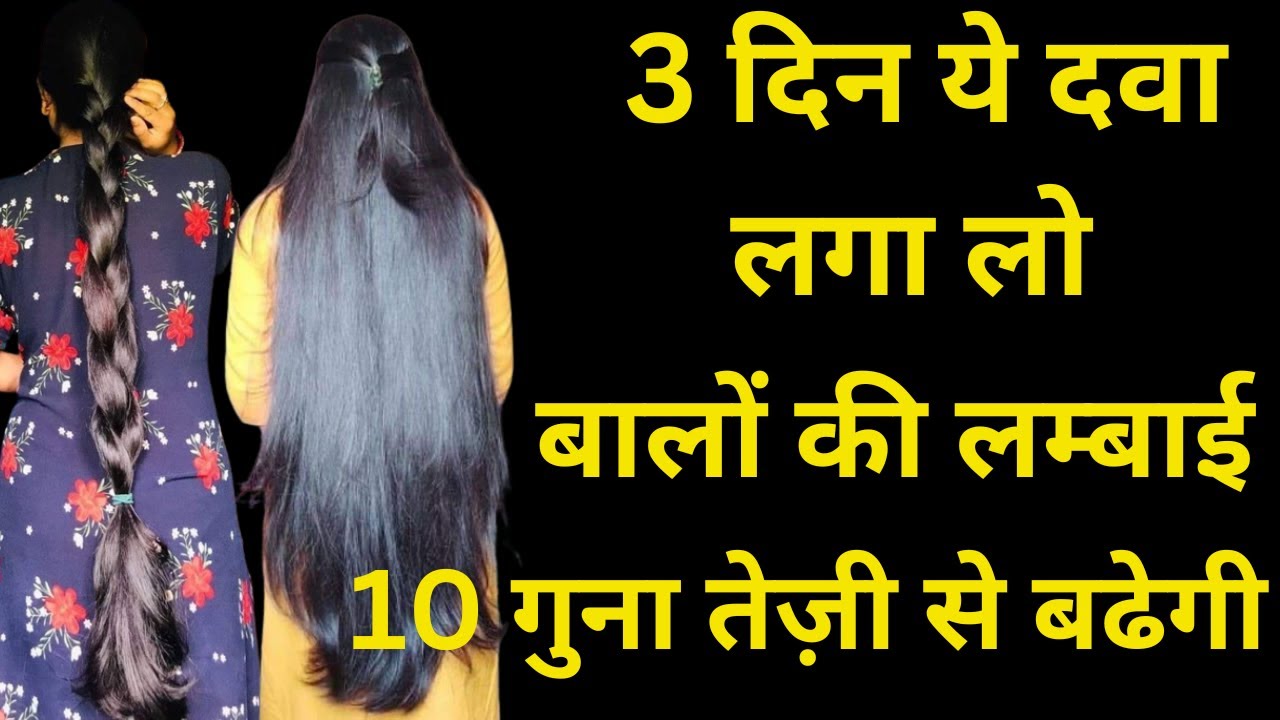 इस दवाई से बालों की लंबाई 10 गुना तेजी से बढ़ेगी / hair growth