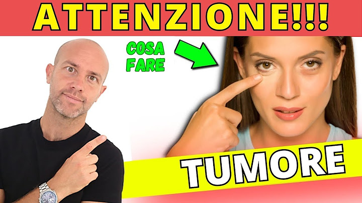 INCREDIBLE! Here's what happens to tumors when you start a fast (scientific studies!!!)