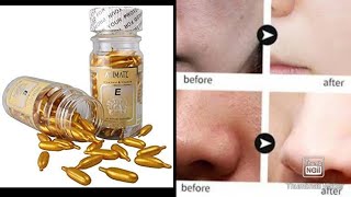 animate vitamin e & aleo vera capsul| facial oil| glowing skin,baby skin,remove ageing