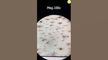 Why Remove Shrimp Intestines | TULO - Microscope #shorts #microscope #shrimp #bacteria