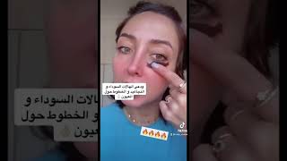 ماسك يخلصك من الهالات السوداء من اول مره 