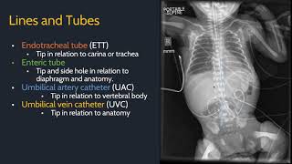 Approach to pediatric radiology screenshot 4