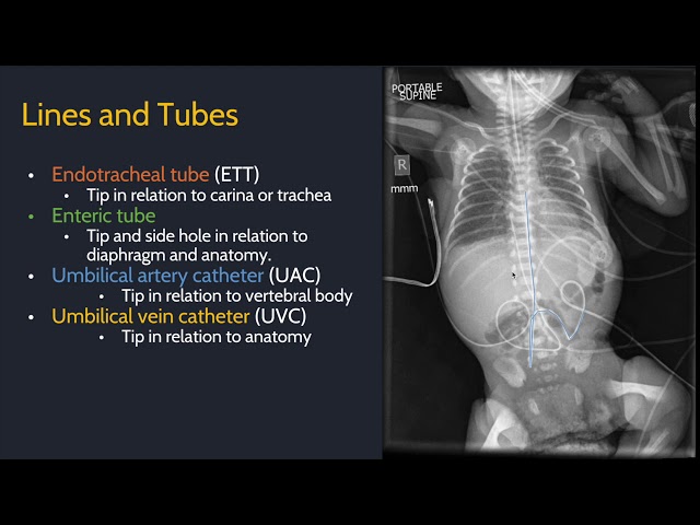 Approach to pediatric radiology class=