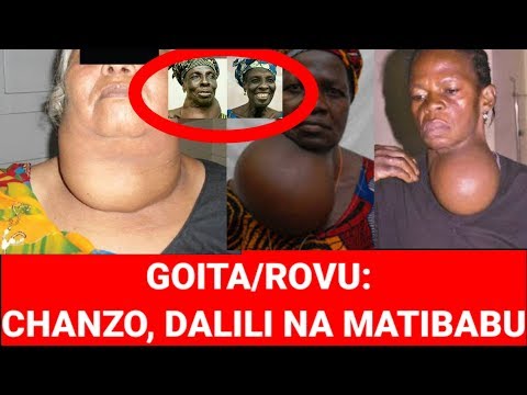 GOITA/ROVU CHANZO DALILI NA TIBA