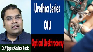 Urethral Stricture Surgery Video 4 - OIU (Optical Urethrotomy) screenshot 5