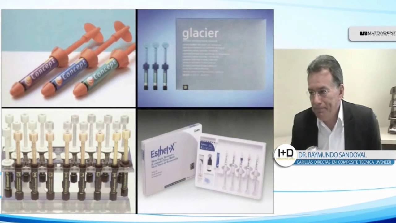 Carillas Directas en Composite: Técnica Uveneer