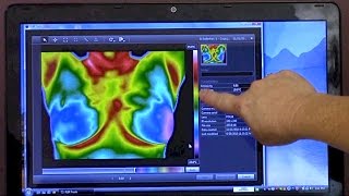 WHAT IS THERMOGRAPHY? INTERVIEW WITH BOSTON THERMOGRAPHY CENTER | Cancer Education & Research Inst