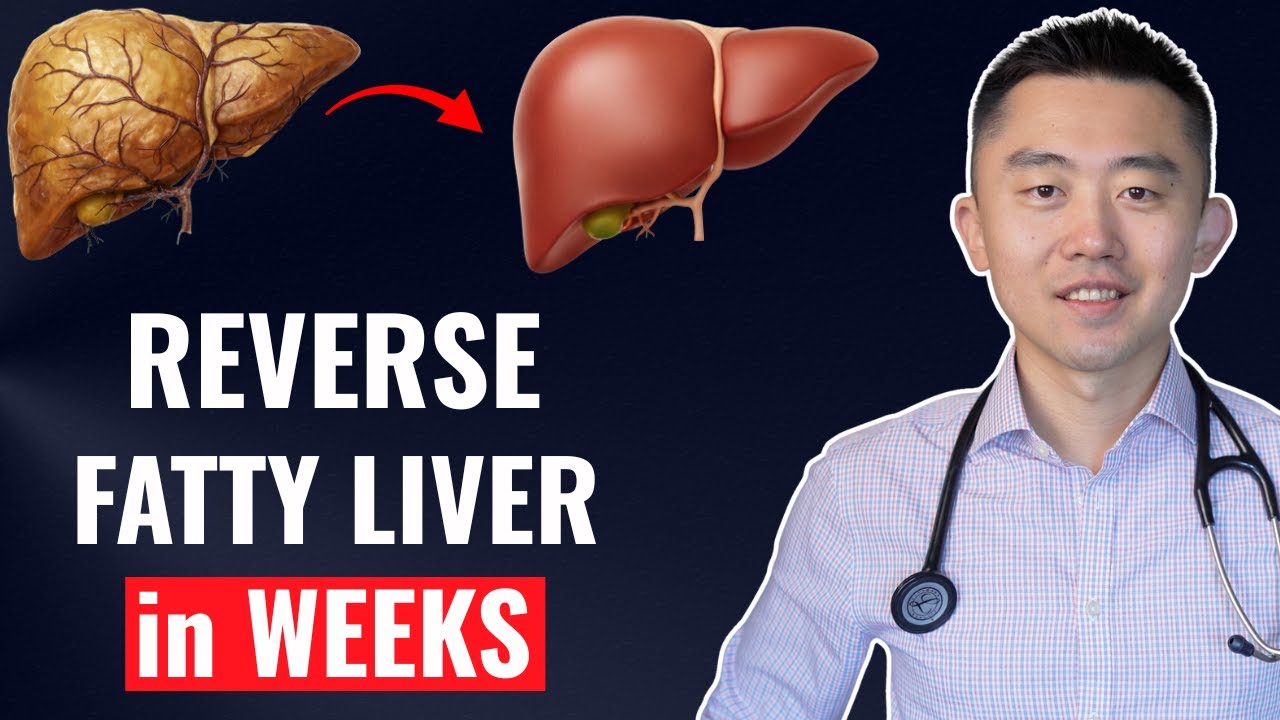 The FASTEST Way to Reverse Fatty Liver, Naturally