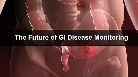 The Future of GI Disease Monitoring - DayDayNews