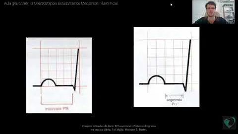 O que significa PR curto no Eletro?