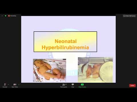 Neonatal Hyperbilirubinemia | Pediatrics