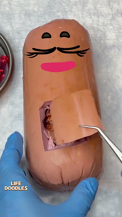 Life Doodles | The sausage operation 😂 #Fruitsurgery #doodles #lifedoodles #shorts #shortvideo