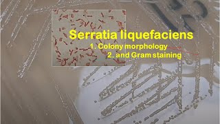 Serratia liquefaciens Colony morphology and Gram staining