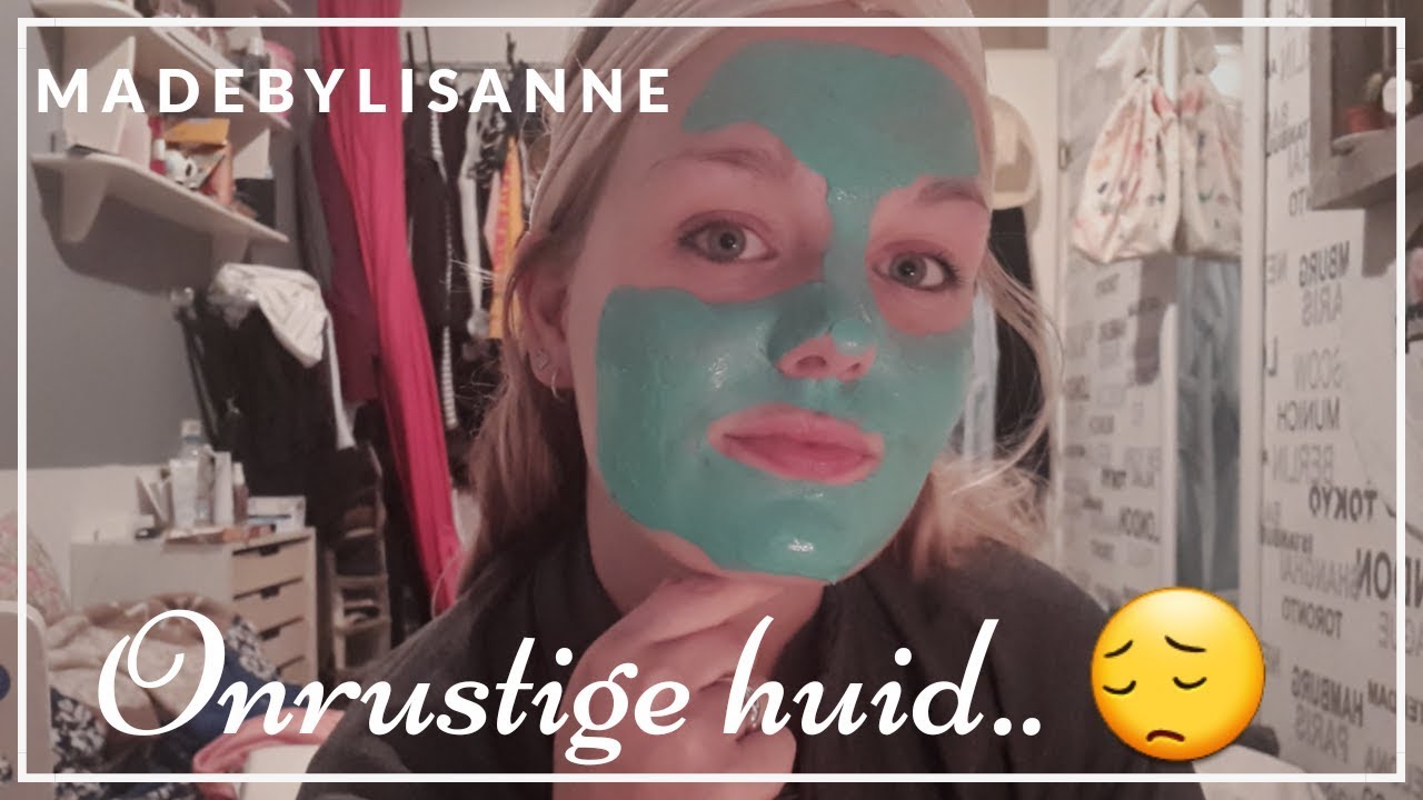 Mega ONRUSTIGE HUID .. - VLOGMAS #8 #70 ☆ Lisanne