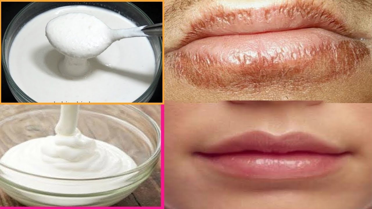 how to get soft hands naturally at home