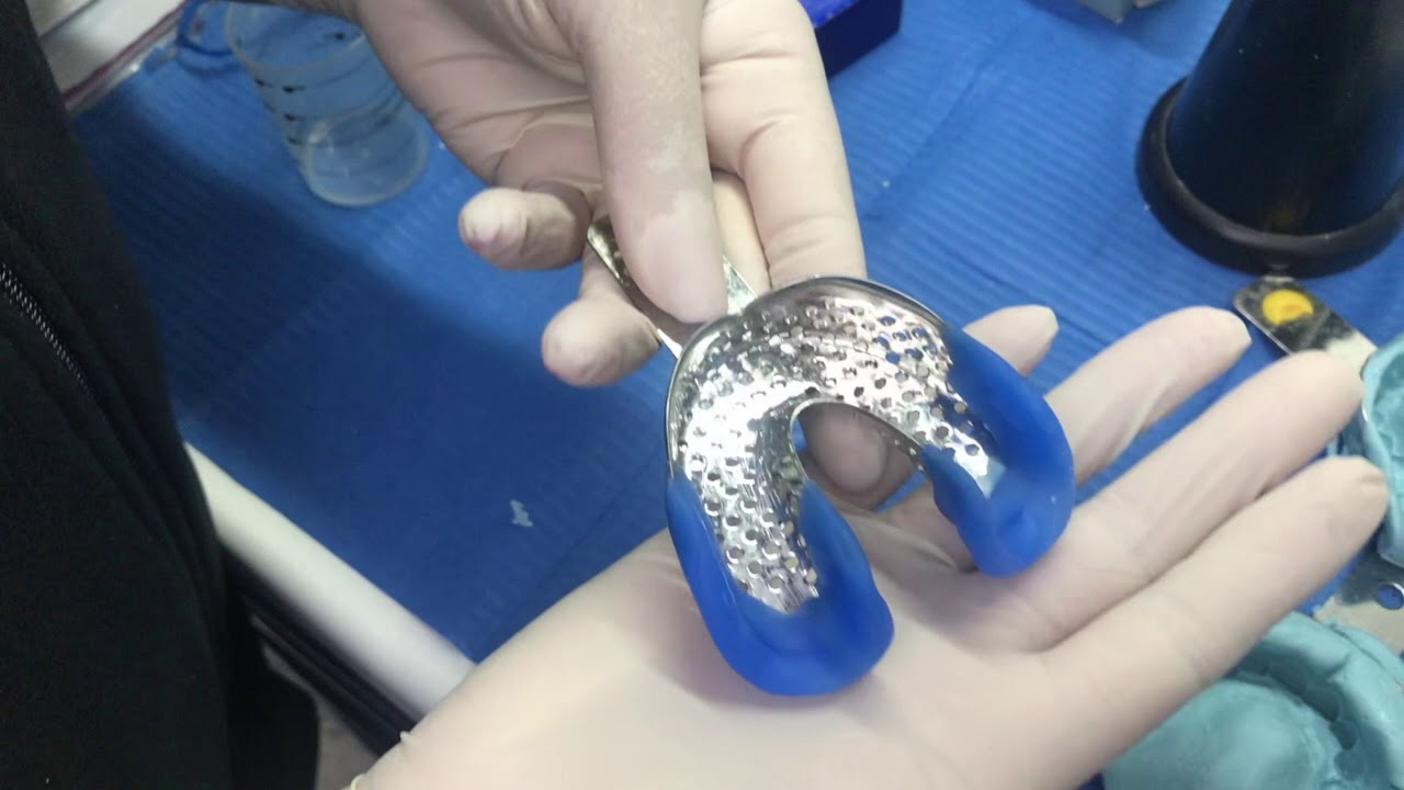 IL BOXAGGIO DEL PORTAIMPRONTA